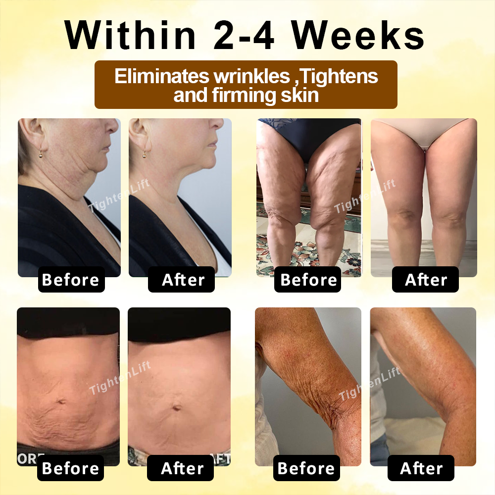TightenLift™ Botox Sheep Placenta MultiFirming Cream