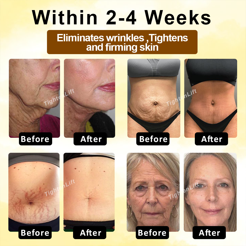 TightenLift™ Botox Sheep Placenta MultiFirming Cream