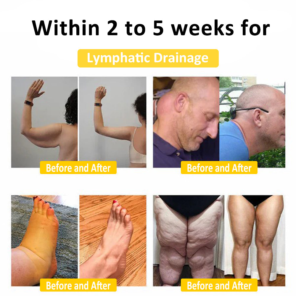 🐝 ATTDX™ Bee Venom Lymphatic Drainage Slimming Soap🔥 (for all lymphatic problems and obesity)