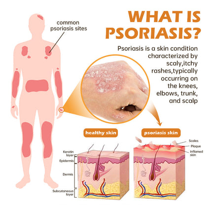 ATTDX™ BeeVenom PsoriasisCream Y