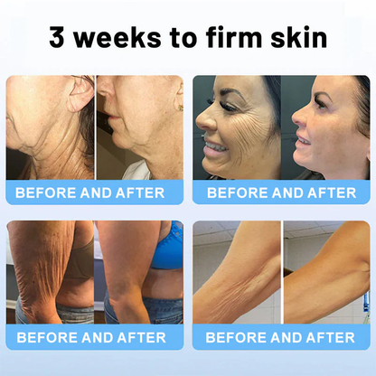 BodyPro™ Tone and Smooth WrinkleRemoval Cream