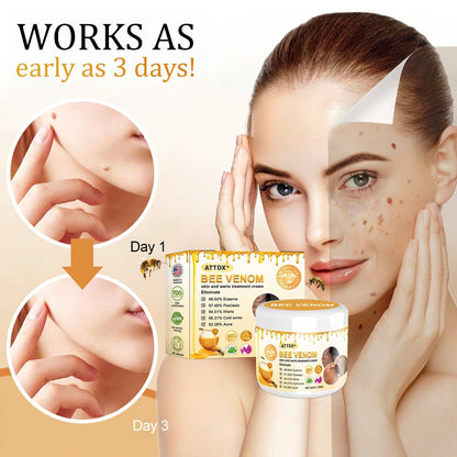 ATTDX Bee Venom Mole and Wart Treatment Cream Y