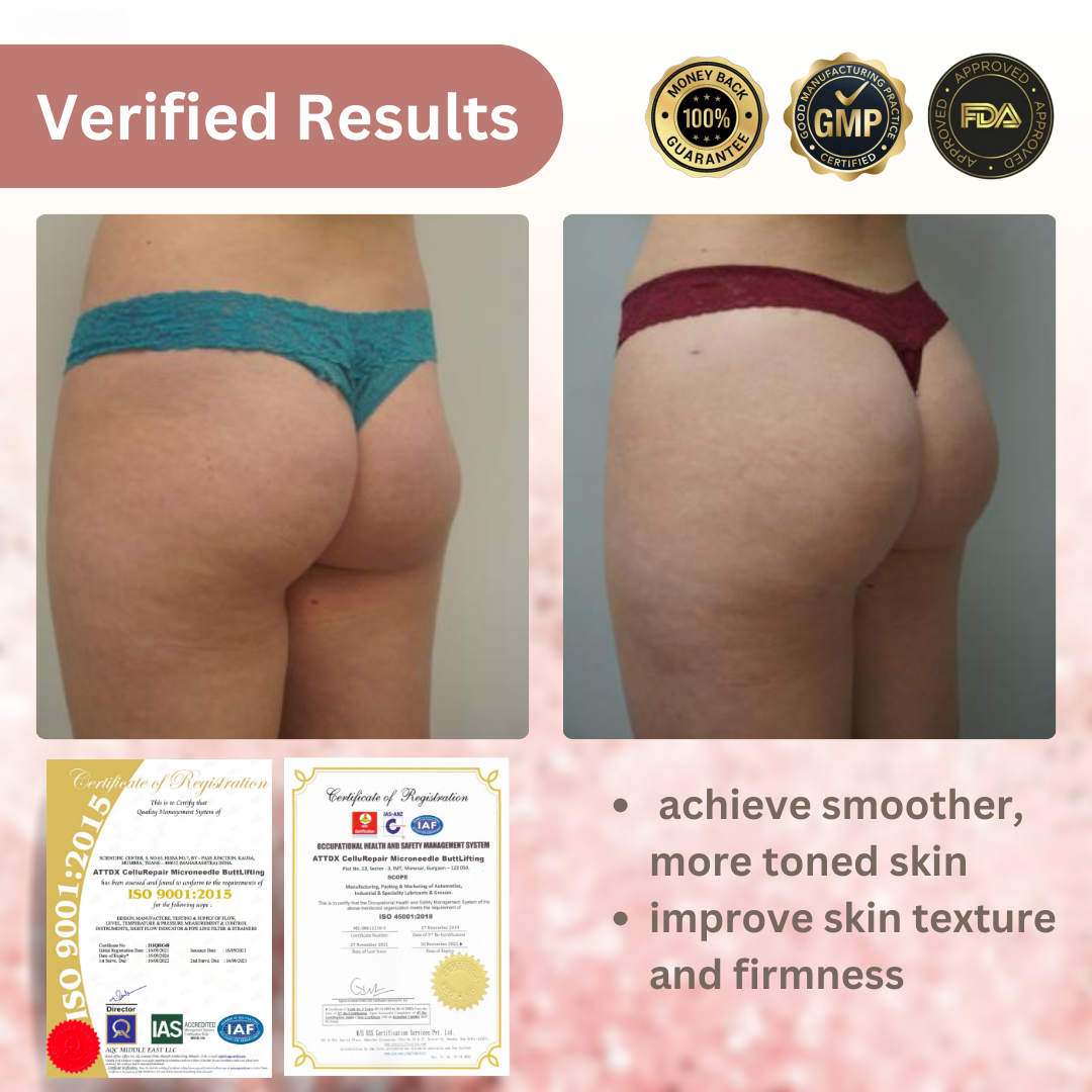 CelluRepair Microneedle ButtLifting Patch