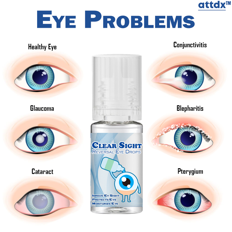 Clear Sight Treatment Reversal Eye Drops bad