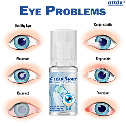 Clear Sight Treatment Reversal Eye Drops bad