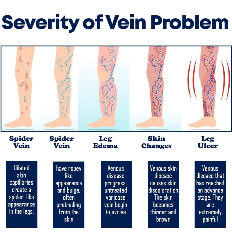 VeinsCare LegSoothe Cream