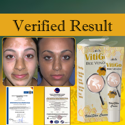 VitiGO Bee Venom VitalSkin Cream Y