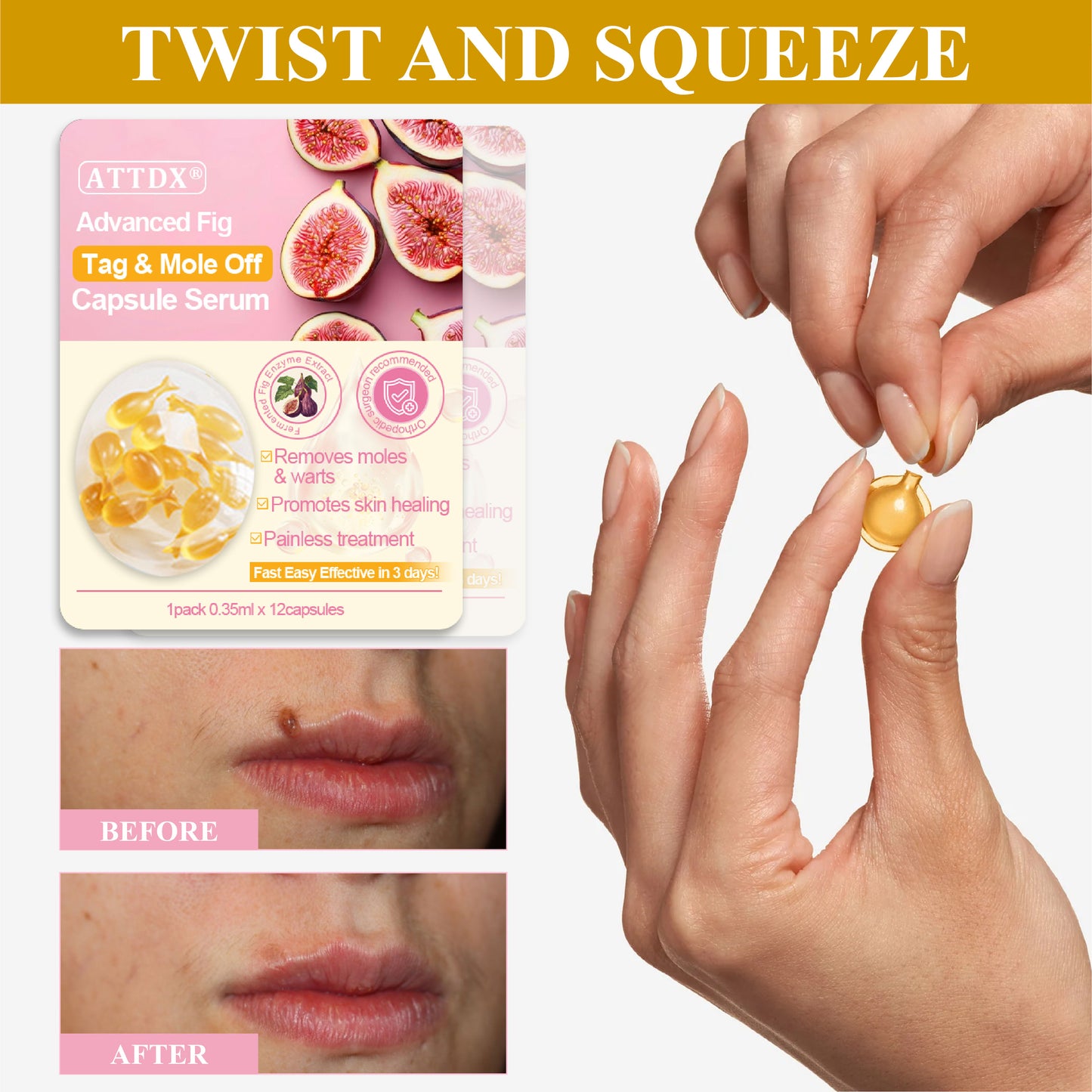 ATTDX® Advanced Fig Tag & Mole Off Capsule Serum