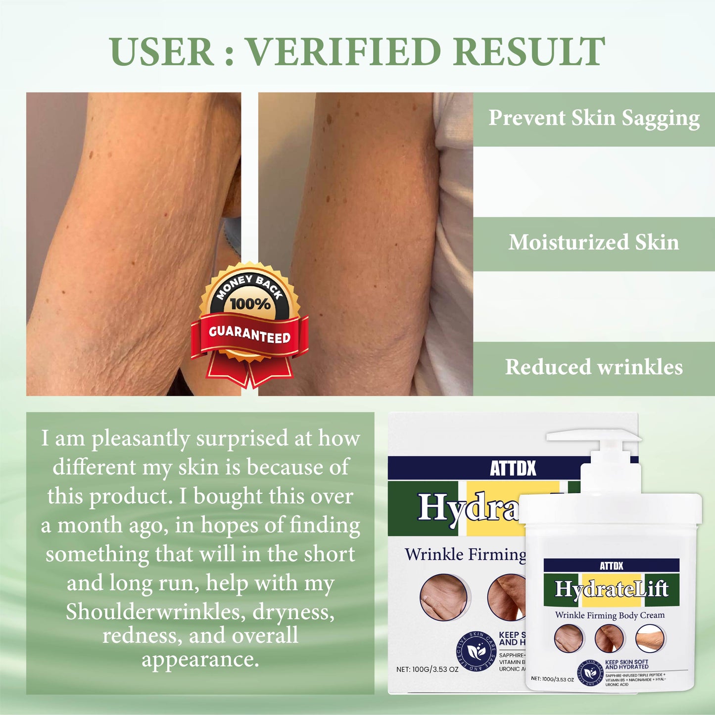 💥💚[✨Last Day Discount：60% OFF✨] ATTDX™ HydrateLift WrinkleFirming Body Cream(👨‍⚕𝐀𝐀𝐃 𝐑𝐄𝐂𝐎𝐌𝐌𝐄𝐍𝐃𝐒👨‍⚕)