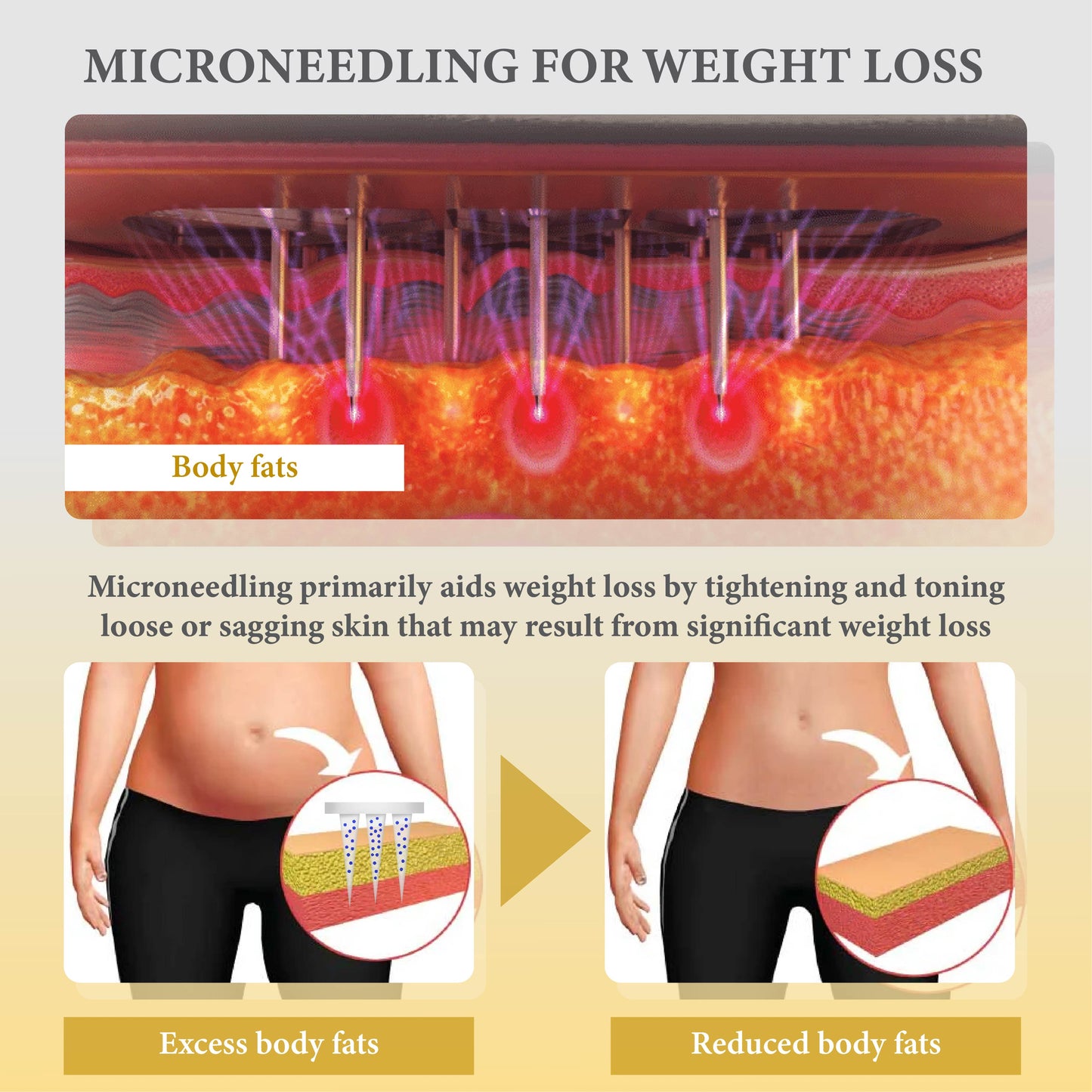 Mircroneedle BeeVenom LipidRefine Patch