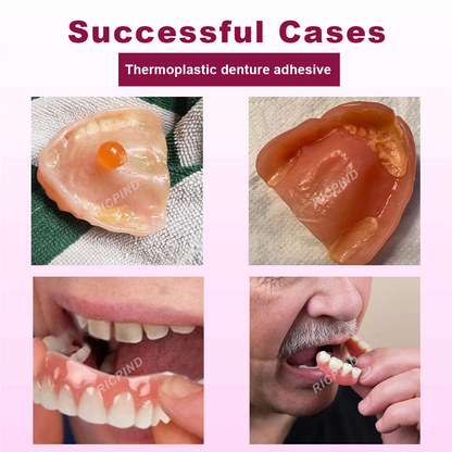 ATTDX™ SmileGrip Thermoplastic Denture Adhesive