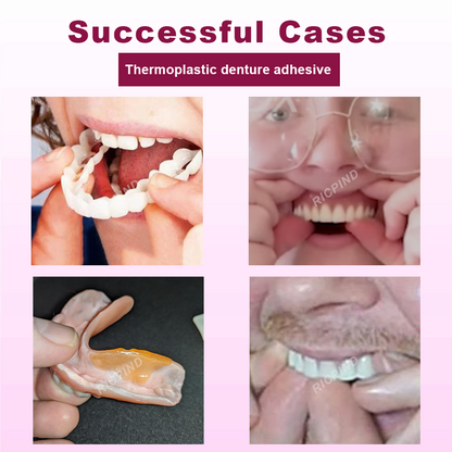 ATTDX™ SmileGrip Thermoplastic Denture Adhesive