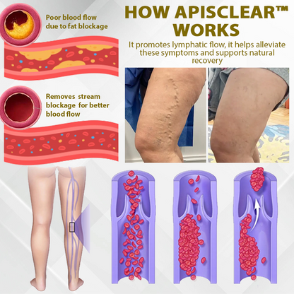 ApisClear™ ApisVenom Advanced Skin Treatment Cream