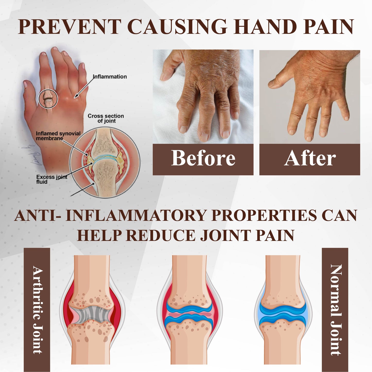 ATTDX® Emu Oil Turmeric Bone Sooth Gel