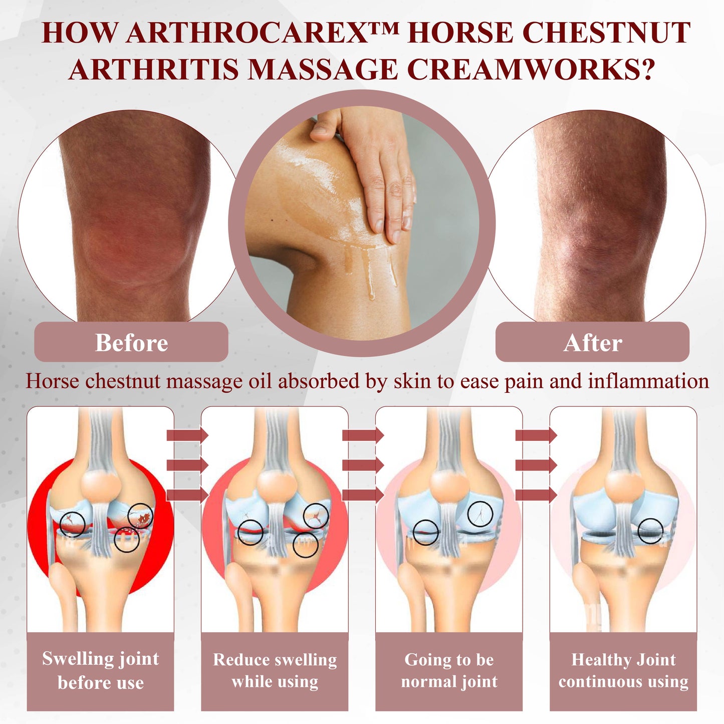 ArthroCareX™ Horse Chestnut Arthritis Massage Cream