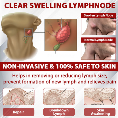 EdemaCare™ LymphDrain Horse Chestnut Massage Cream