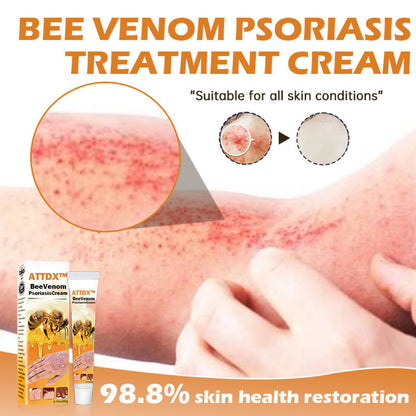 ATTDX™ BeeVenom PsoriasisCream