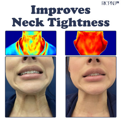 IONIC Therapy NeckPain ReliefPad