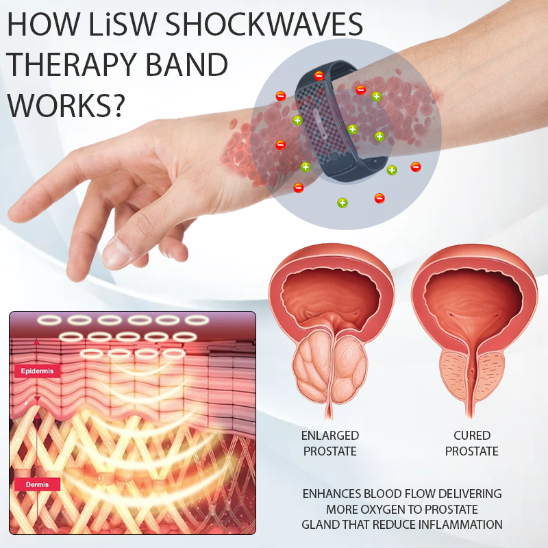 RICPIND™ LiSWT Therapy ProstateCare Band 2